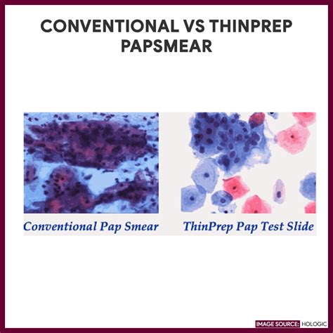 coccobacilli pap test|Reliability of conventional Papanicolaou smear in diagnosing .